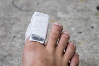 Surgery or Buddy Taping?
