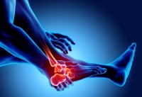 Helping Someone You Love With Arthritis