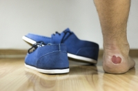 Foot Blisters and Socks