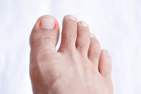 What Can Cause an Ingrown Toenail?