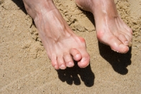 Mild Relief Options for Hammertoe