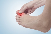 Facts About Gout