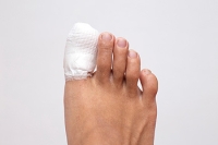 Toeing the Line on Toe Pain